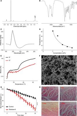 Locally Controlled Release of Methotrexate and Alendronate by Thermo-Sensitive Hydrogels for Synergistic Inhibition of Osteosarcoma Progression